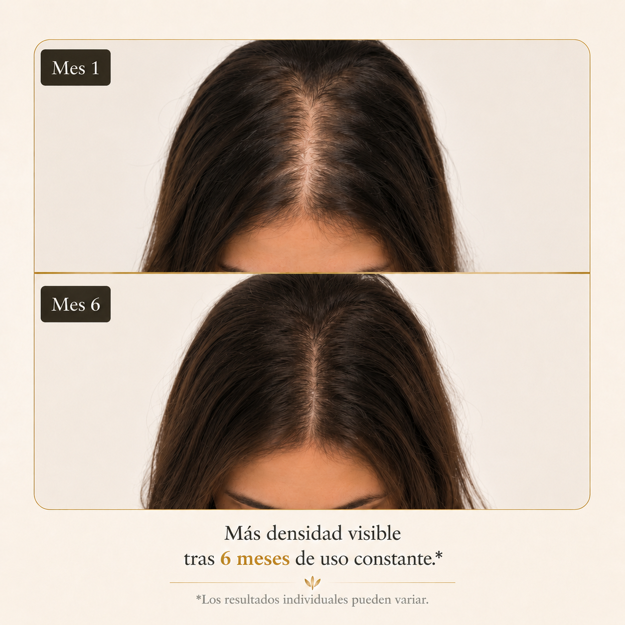 Aceite AntiCaída Capirus - La solución más fácil para evitar perder pelo