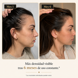 Aceite AntiCaída Capirus - La solución más fácil para evitar perder pelo
