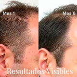 Aceite AntiCaída Capirus - La solución más fácil para evitar perder pelo