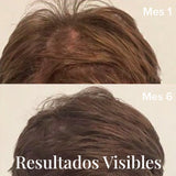 Aceite AntiCaída Capirus - La solución más fácil para evitar perder pelo