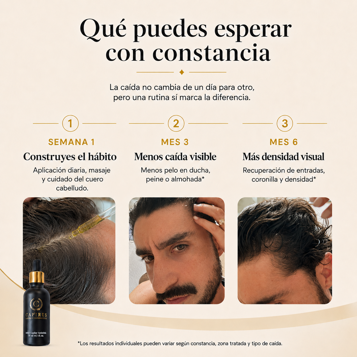 Aceite AntiCaída Capirus - La solución más fácil para evitar perder pelo