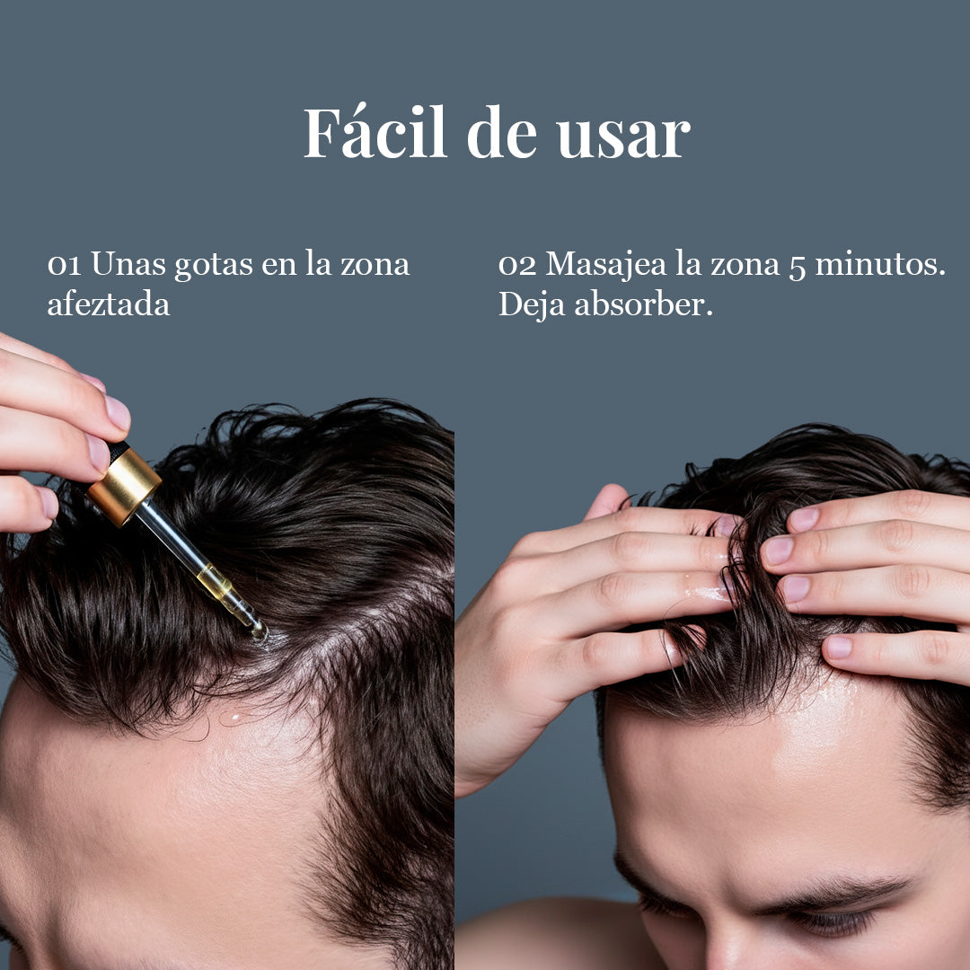 Aceite AntiCaída Capirus - La solución más fácil para evitar perder pelo