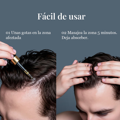 Aceite AntiCaída Capirus - La solución más fácil para evitar perder pelo